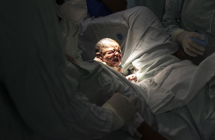 neonato morto durante allattamento
